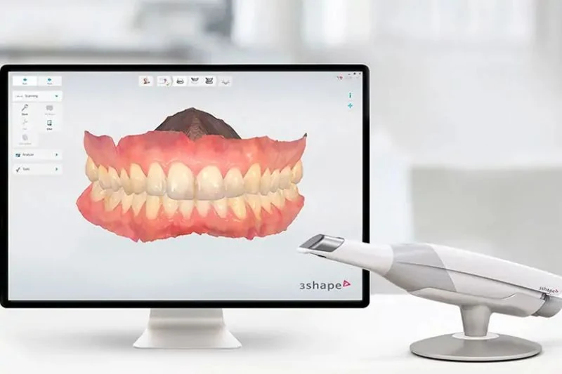 Escáner intraoral 3Shape TRIOS
